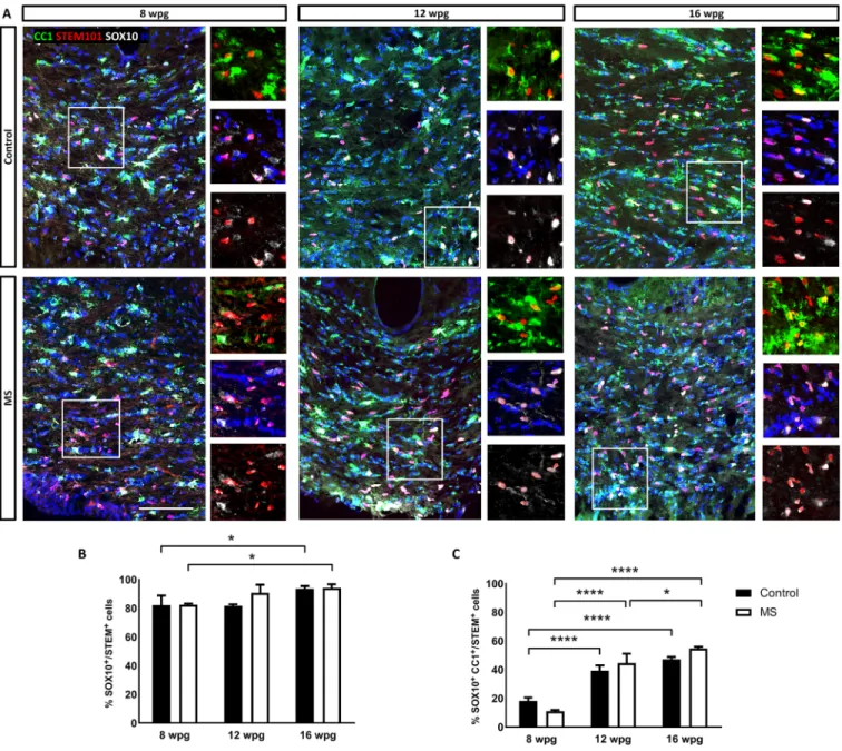 Fig. 2. Differentiation of MS-hiOLs into mature oligodendrocytes is timely regulated in the corpus callosum of the developing Shi/Shi:Rag2 −/−  brain