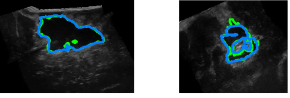 Figure 5: Per case results (green: ground truth, blue: prediction)