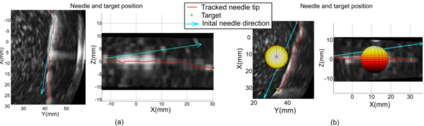 Figure 6 shows tracking results of a double-bend path and  the profile of the insertion speed