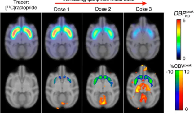 Fig.  3  Parametric  maps  showing  the  results  from  increasing  doses  of  the  dopamine D 3 -receptor agonist quinpirole