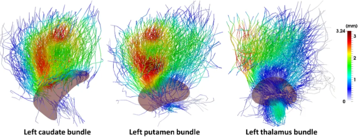 Figure 9: Shape dissimilarities of the fiber bundles between the two groups. Colors refer to the absolute value of the di ff erence between the displacements from the final template complex to the average configurations of patients and controls
