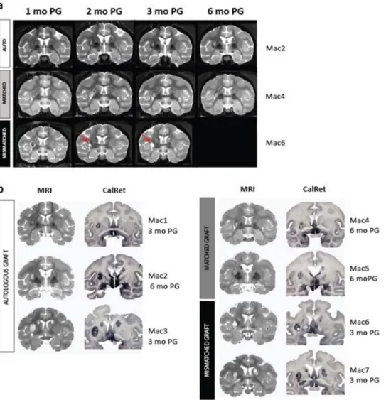 Figure 4: Graft size, location in QA lesioned NHPs analyzed in vivo with MRI. (a) Representative coronal images of the  longitudinal MRI follow-up of CTP derivatives after intra-striatal transplantation in autologous (white), MHC-matched  (grey) and MHC mi