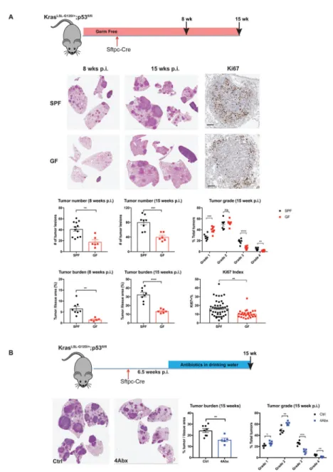 Figure 1. Commensal microbiota promote development of lung adenocarcinoma.