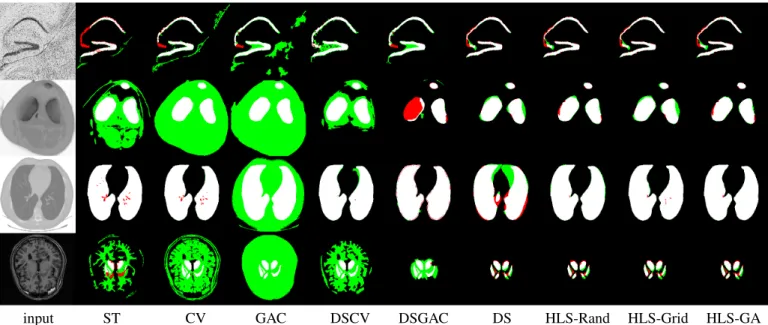 Table IV: Segmentation Results using Dice Similarity Coeffi- Coeffi-cient (DSC). Values are sorted in descending order.