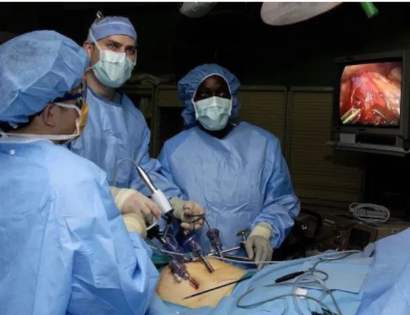 Figure 1. Classic Laparoscopic Surgery. The surgeon holds instruments  and an assistant the endoscope and an instrument