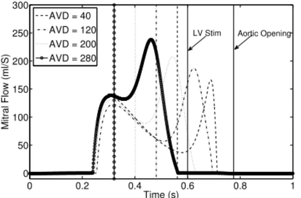 Figure 3. Results of Morris sensitivity analysis carried out on maximum E-wave.
