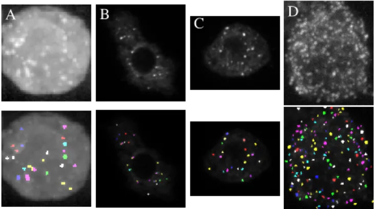 Fig. 3. Examples of real images (top) and the corresponding SPADE detections (bottom) Particles are fusion proteins (Green  flu-orescent protein-Imp), except (D): in situ hybridization with quasar 570-marked oligonucleotidic probes.