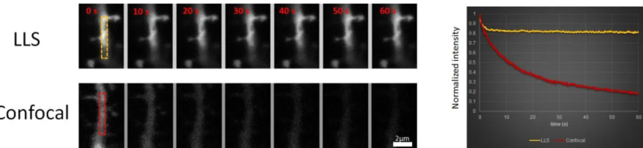 Figure 3: tdTomato labeled dendrites in a fixed hippocampal slice were acquired continuously at 10 fps for 60 s