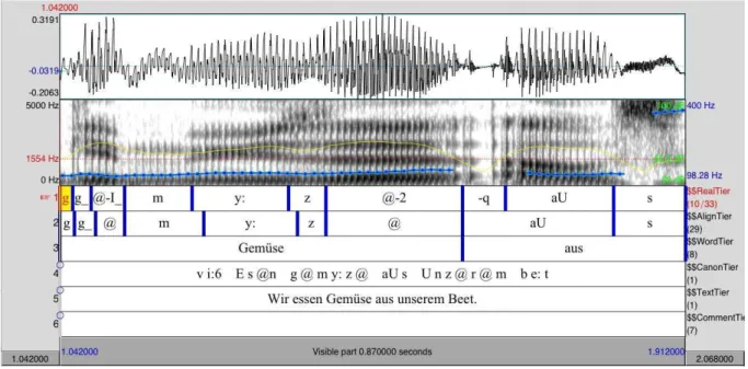 Figure 1: Automatic alignment and corrections of a German sentence produced by a  French speaker learning German  (FG) “Wir essen Gemüse aus unserem Beet” – “We eat vegetables from our patch” 