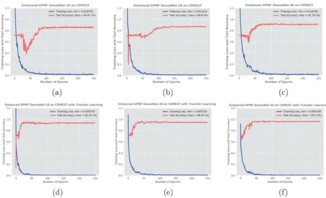 Fig. 7. Learning curves of the three proposed deep networks (DenseNet-16, DenseNet- DenseNet-28, DenseNet-40) on CEMEST dataset when trained from scratch (a)-(b)-(c) and  fine-tuned on CEMEST dataset (d)-(e)-(f)