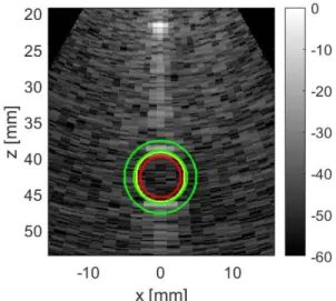 Fig. 3 Phantom 3D image slices for contrast (two left hand columns designated by letter A) and resolution (two right hand colomns designated by letter B) evaluation comparison between the optimal sparse array (opti256, top line) and the reference array (re