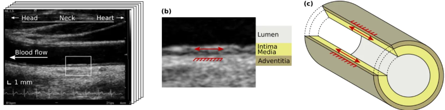 Fig. 1. Longitudinal kinetics (LOKI) of the arterial wall. (a) Temporal sequence (movie clip of several images) of the common carotid artery in B-mode ultrasound