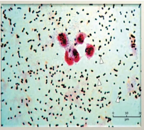 Figure 7 . Aspect microscopique de S.pneumoniae (Van der Poll &amp; Opal, 2009) 