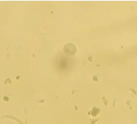 Figure 6: Dientamoeba fragilis identifié par la méthode de Willis à l’objectif 40                                                               [Photo du service de parasitologie, HMIM V]
