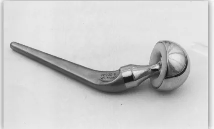 Figure 5 : Photographie d’une prothèse intermédiaire [13] 