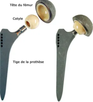 Figure 7 : Composants d’une prothèse totale de hanche [17] 