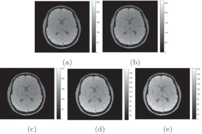 Fig. 3: (a) Ground truth, Restored image by : (b) the SENSE method, (c) the proposed sparse model, (d) the Bayesian ℓ 2