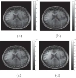 Fig. 5: Difference images between SENSE and (a) the pro- pro-posed model, (b) the Bayesian ℓ 2 regularization, (c) the Tikhonov regularization, for R = 2 and R = 4.