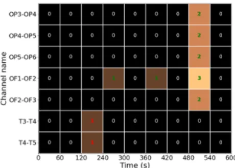 Figure 10: Image after application of a low pass filter. All the high densities are removed to display only the IESs.