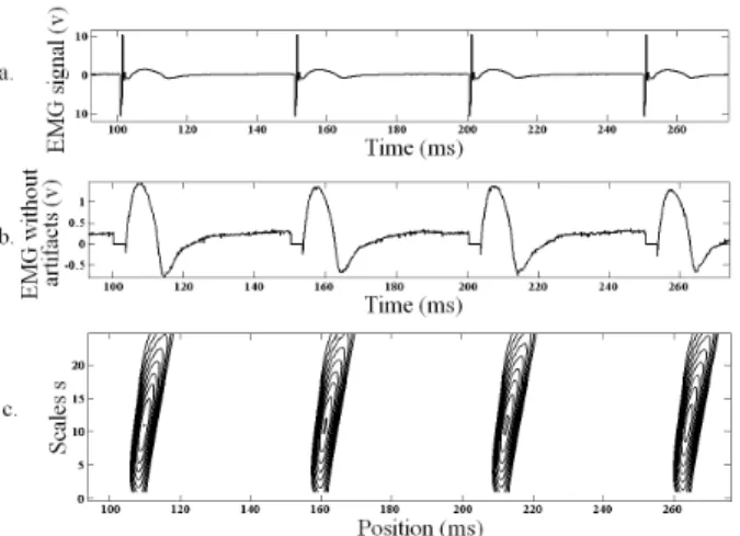 Fig. 5. Waveforms that can be sent to the stimulation board. a. Monophasic.