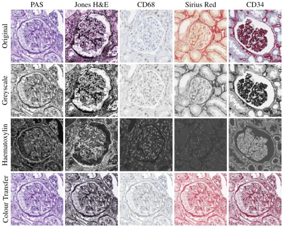 Fig. 1: Glomeruli patch examples with different transformations. Each column corresponds to a different staining, and each row a transformation