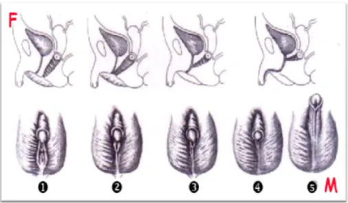 Figure 4 : Les différents stades de Prader 