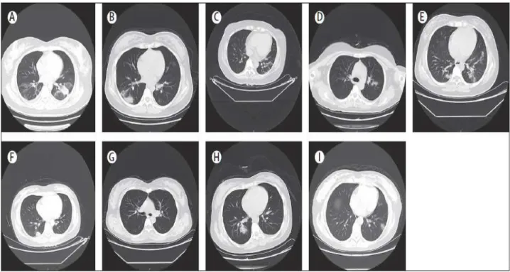 Figure 10 : Les Scanners thoraciques des 9 patientes dans la série de Chen et al [92] 