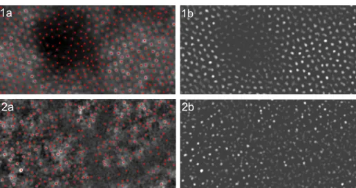 Fig. 2. Illustration of the deconvolution interest. 1a and 2a: results of our new algorithm on the original images 1 and 2
