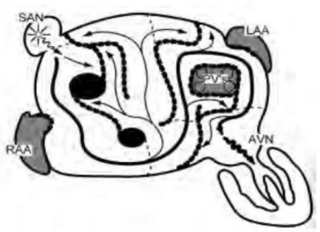 Figure 5: Schématisation de la procédure de MAZE III (d’après McKellar SH. 2003) 