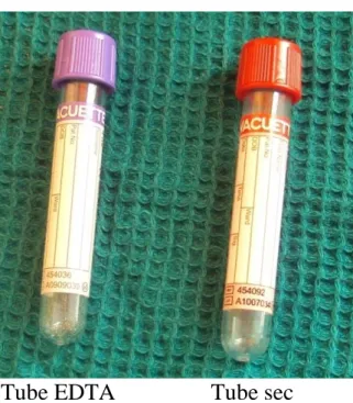 Figure 1 : Tubes de prélèvement utilisés pour un bilan biologique  allergologique 