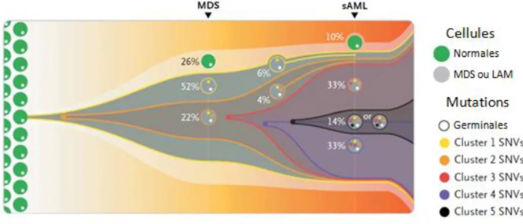 Figure 6 : Exemple d'évolution clonale chez un patient atteint de LAM secondaire  à un syndrome myélodysplasique