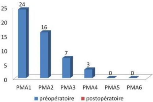Fig. 3 : Etude de la douleur selon la cotation PMA en pré-opératoire 