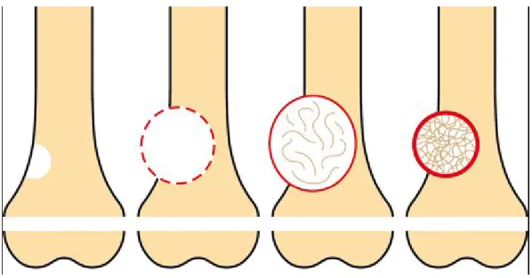 Figure 11 : phases de maturation du KOA 
