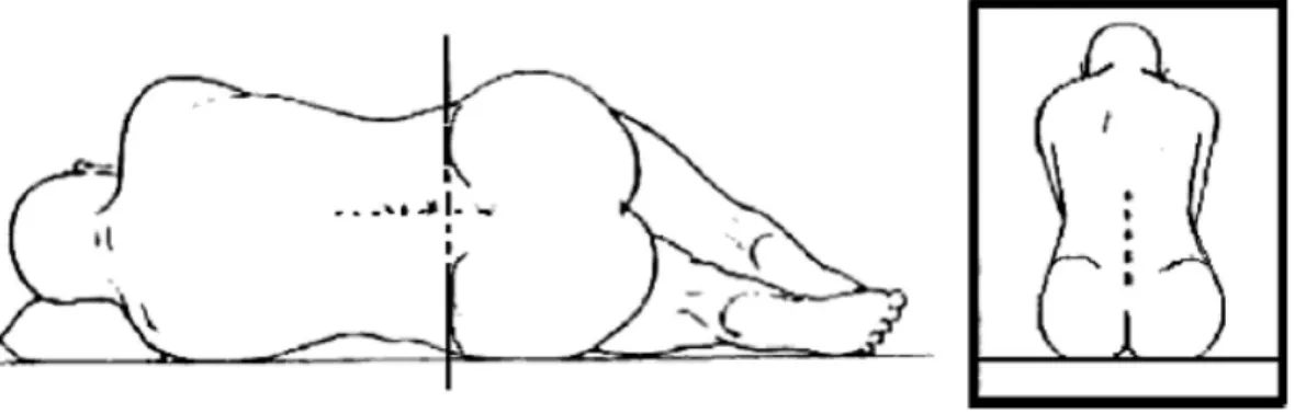 Figure 3 : Repères anatomiques de la Ligne de Tuffier 