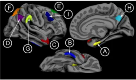 Figure   5.   Regions   of   cortical   thickness   affected   in   Alzheimer’s   disease   patients   (image   from    Dickerson    et    al.,    2009)