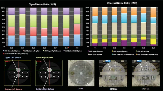 Fig. 1. Post-hoc inter-scanner signal repeatability. Relative stacked column graphs show comparable SNR and CNR values in I-ADNI qualified centers