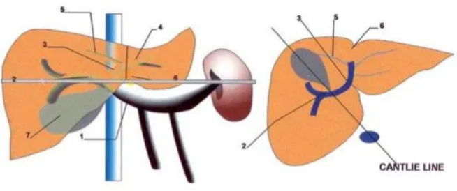 Figure 12: anatomie modale intra-hépatique. 1 Tronc porte. 2 Branche droite. 3 Branche  gauche