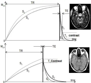 Figure 1.2.7: T1 and T2 contrast illustration in a typical spin-echo sequence. Top graph il- il-lustrates the T2 contrast that depends on TE