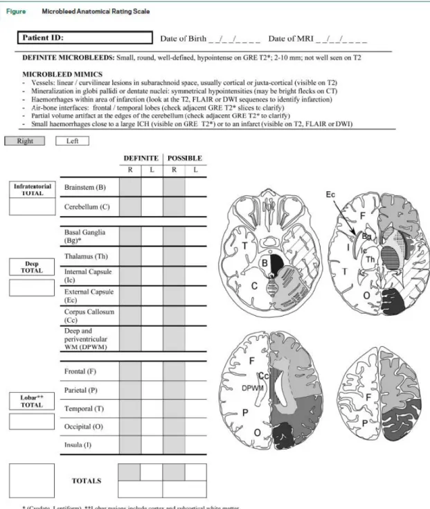 Figure 1.3.2: Microbleed Anatomical Rating Scale [Gregoire et al., 2009]