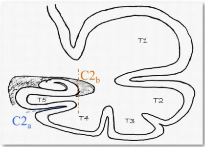 Figure 4.7: criterion C2 : verticality and depth of the collateral sulcus. The segment a indicates the collateral sulcus, and b the lateral part of the hippocampus