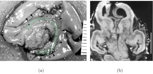 Figure 2.6: 13 GW. (a) Photography from Kier et al. (1995) in sagittal plane of the medial brain surface of a 13 GW foetus