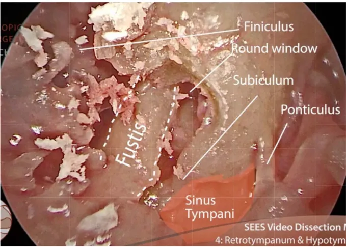 Figure 33 : Image en