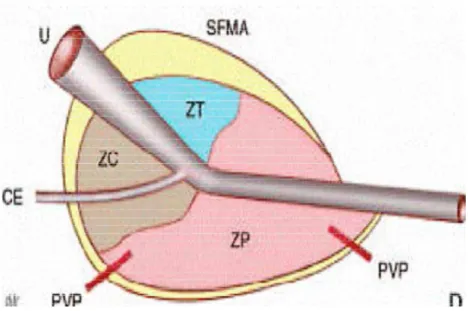 Fig. 2 : Schéma de l’anatomie zonale de la prostate 