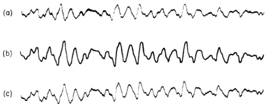 Fig.  VII-27  Performance  of  one  channel  of  the  recorder  with  a  brainwave  signal.