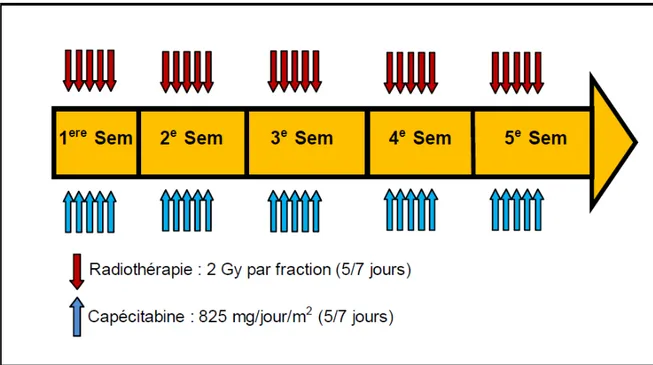 Figure 3 : Protocole de radiochimiothérapie néoadjuvante en 50 Gy. 