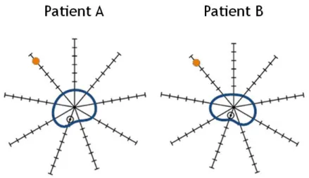 Figure 1.16: Schéma en vue axiale  de la mise en correspondance basée sur la prostate  (bleu)  entre un patient  A et un  patient B d’un voxel (orange)