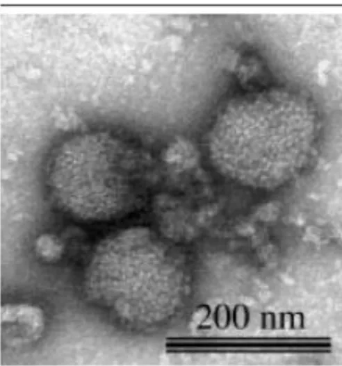 Figure 2 : Electromicrophotographie du virus de la grippe A. 