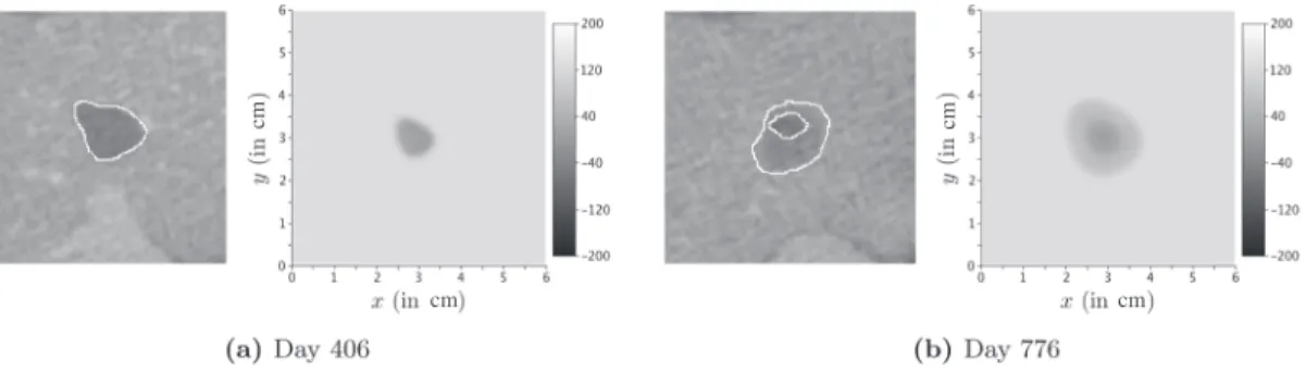 Fig. 2. Comparison between CT scans of Patient A and the numerical simulations.