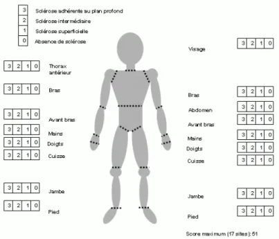 Figure 4: Score de Rodnan modifié : évaluation de l’extension cutanée 