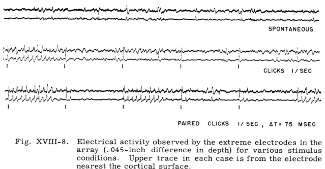 Figure  XVIII-8  shows  some  potentials  obtained  from  the  two  extreme  wires  of  the multiple  electrode  under  three  different  conditions:  (a)  spontaneous  activity;  (b)  single clicks,  1/sec,  VDL  +  30  db;  and  (c)  paired  (At=75  msec